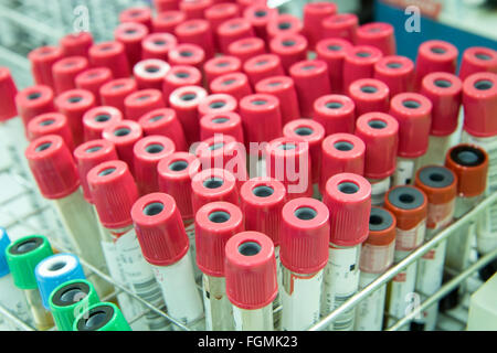 Tubos con sangre en el laboratorio en la mesa. Foto de stock