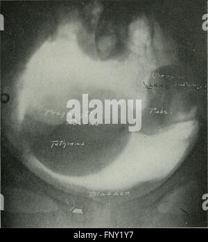 El American Journal of roentgenology, radium terapia y medicina nuclear (1906) El American Journal of roentgenology, radium terapia y medicina nuclear (1906)