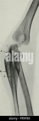 Viviendo la anatomía y de la patología; el diagnóstico de enfermedades en los primeros años de vida por el método Roentgen (1910)