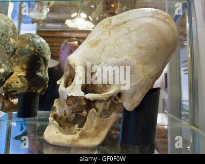 Alargar el cráneo de los antiguos derechos de Paracas se muestra en el Museo de Historia de Paracas Foto de stock