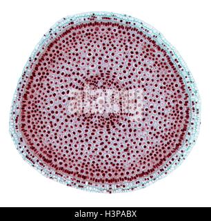 La mitosis. Micrografía de luz (LM) de una sección transversal de la cebolla (Allium cepa) raíz sugerencia para mostrar células experimentando mitosis (división nuclear). Ampliación: x100 cuando imprima en 10 centímetros de ancho. Foto de stock