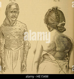 Un tratado práctico de las enfermedades de la piel, para el uso de estudiantes y profesionales (1883)