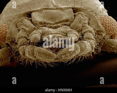 Micrografía electrónica de la cabeza de un webspinner (Embioptera)