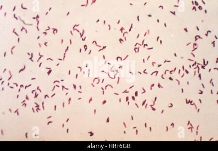 Corynebacterium diphtheriae фото