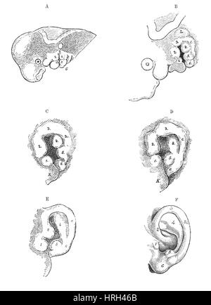  Desarrollo embrionario humano Imágenes de stock en blanco y negro