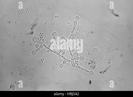 Candida albicans, infección micótica LM Fotografía de stock - Alamy