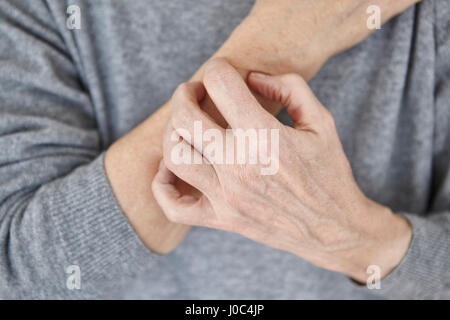 Mujer Senior rascarse el brazo, close-up Foto de stock