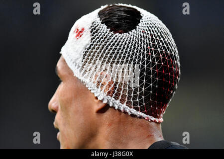 El jugador del FC Internazionale Jeison Murillo con lesiones en la cabeza en el estadio de fútbol de san siro, en Milán. Foto de stock