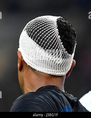 El jugador del FC Internazionale Jeison Murillo con lesiones en la cabeza en el estadio de fútbol de san siro, en Milán. Foto de stock