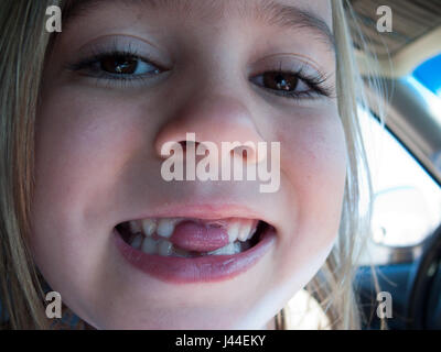 Una niña pega su lengua a través de la brecha dejada de sus dientes perdidos.