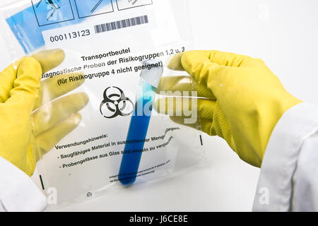 Virus biológico contagio laboratorio de análisis en el estudio del trabajo académico de papel smock