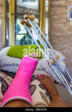 Mujer con fractura de pierna pierna rota en yeso rosado descansa sobre un entrenador Foto de stock