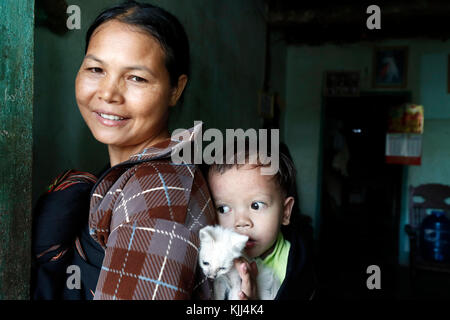 Madre y su joven enfermo de enfermedad del corazón. Kon Tum. Vietnam. Foto de stock