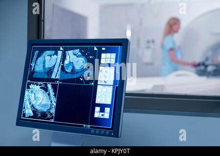Las IRM en el monitor. Foto de stock