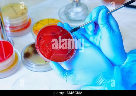 Placa de Petri. Laboratorio Microbiológico. Cultivos de hongos y moho. Investigación bacteriana