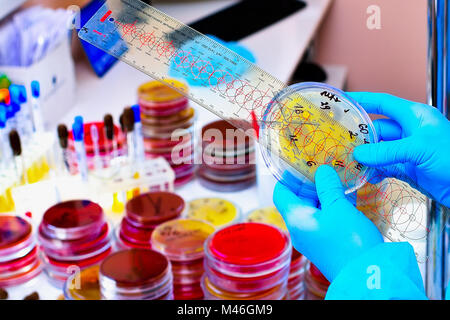 Placa de Petri. Laboratorio Microbiológico. Cultivos de hongos y moho. Investigación bacteriana