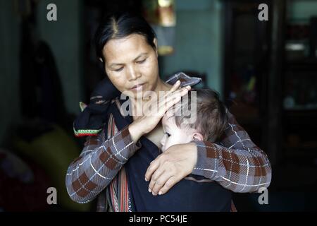 Madre y su joven enfermo de enfermedad del corazón. Kon Tum. Vietnam. Uso | en todo el mundo Foto de stock