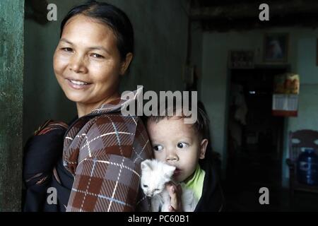 Madre y su joven enfermo de enfermedad del corazón. Kon Tum. Vietnam. Uso | en todo el mundo Foto de stock