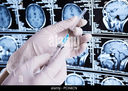 Resonancia magnética del cerebro. Imágenes por resonancia magnética (IRM). Jeringa en mano. Foto de stock