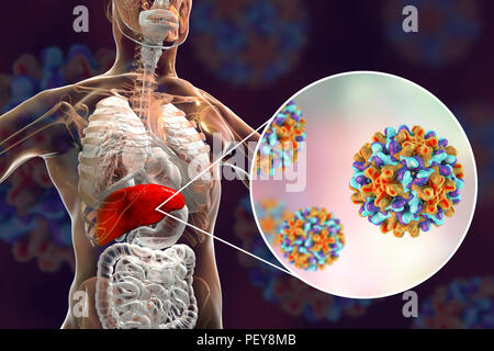 La Infección Por Hepatitis B. Equipo Ilustración Mostrando El Hígado Y ...