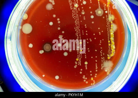 Placa de Petri con colonias de microbios