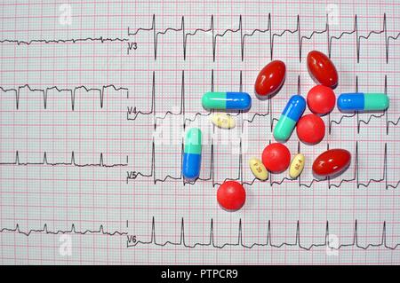 Vista superior de diversos tipos de píldoras, tabletas, medicamentos y drogas en el electrocardiograma (EKG o ECG) antecedentes de papel para el cuidado de la salud y el concepto médico