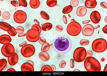 La anemia por deficiencia de hierro Equipo ilustración mostrando la sangre de un paciente