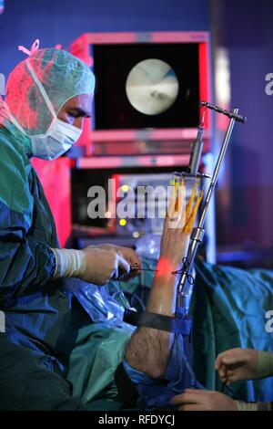La cirugía artroscópica de muñeca. El cirujano ve la articulación en el monitor. Foto de stock