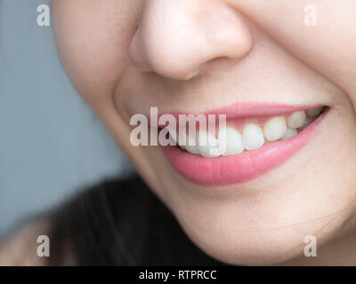 Closeup shot de Asia mujer tailandesa chino maquillaje rostro femenino. Mujer con labios rojos labios y blanco dental sano grandes dientes perfectos. Odontología
