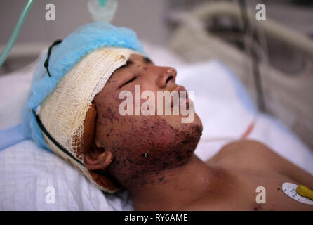 Sanaa, Yemen. 12 Mar, 2019. Un hombre yemenita recibe tratamiento de heridas sufridas durante un ataque aéreo informó en un hospital. Según la ONU, un periodo de 48 horas las huelgas mató a 22 personas, incluyendo una docena de niños, a principios de esta semana. Crédito: Hani Al-Ansi/dpa/Alamy Live News Foto de stock