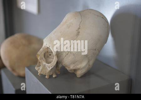 Cráneos alargados del antiguo pueblo de Paracas Foto de stock