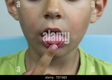 Símbolos de terapia del habla en niños con problemas del habla Foto de stock