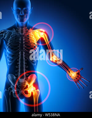 Hombre con dolor en las articulaciones - Ilustración 3D Foto de stock