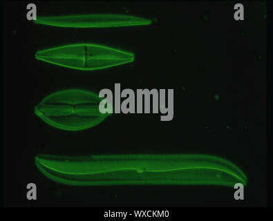 Las diatomeas del mar bajo el microscopio 100x