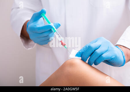 Close-up d'un cosmetologist portant des gants chirurgicaux bleu beauté permet d'injection sur le genou de la femme Banque D'Images