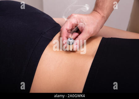 Une vue de dessus d'un médecin d'effectuer une thérapie Moxibustion SUR UNE PATIENTE Retour Banque D'Images
