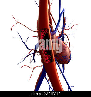 L'artère, l'artère illustré avec une section, le rendu de haute qualité avec des textures originales et de l'illumination globale, la contraction des vaisseaux sanguins Banque D'Images