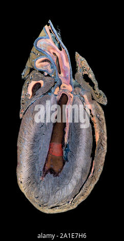 La section pied fœtal humain montrant structure générale, darkfield photomicrographie Banque D'Images