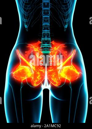 L'inflammation des ligaments, illustration ordinateur conceptuel Banque D'Images