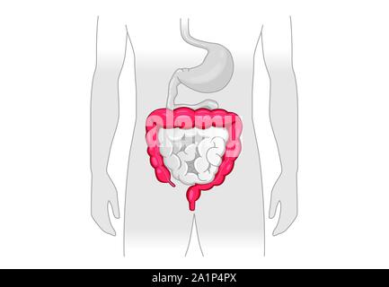 Illustration à propos de symptôme anormal des droits de gros intestin. Illustration de Vecteur