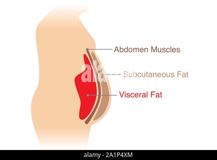 Emplacement de la graisse viscérale stockées à l'intérieur de la cavité abdominale. Illustration sur le schéma médical. Illustration de Vecteur