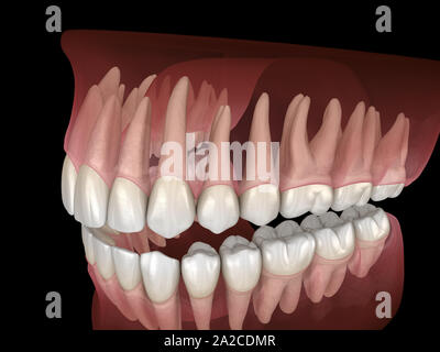 De la morphologie des maxillaires et mandibulaires et des dents gencives. Dent précise médicalement 3D illustration Banque D'Images