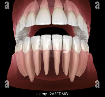 De la morphologie des maxillaires et mandibulaires et des dents gencives. Dent précise médicalement 3D illustration Banque D'Images