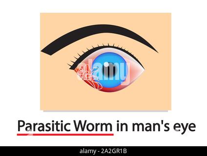 Libre de vers parasites dans l'oeil humain, vector art design Illustration de Vecteur