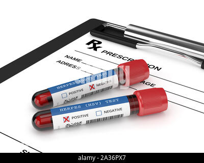Rendu 3D d'échantillons de sang avec l'essai de l'herpès sur fond blanc Banque D'Images