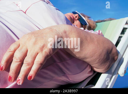 Grosse femme sur chaise longue Banque D'Images