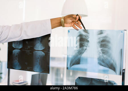 African American health care worker with x-ray. Portrait de la main de l'homme African doctor pointing at image de radiologie thoracique du patient Banque D'Images