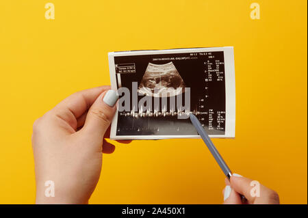 Battement de coeur de bébé dans le ventre de la photo d'échographie Banque D'Images