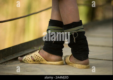 Sapa, SAPA, Vietnam - Mars 21, 2011 : Détail de pieds fille Hmong Banque D'Images