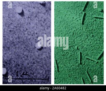 Photographie de virus influenza prises au moyen d'un microscope. La grippe est communément appelée la grippe. Également sur la photo si le virus de la mosaïque du tabac pris à travers un microscope. Le TMV est un virus qui infecte un nombre de plantes. En date du 20e siècle Banque D'Images